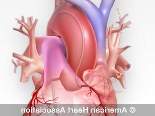 cardiac catheter